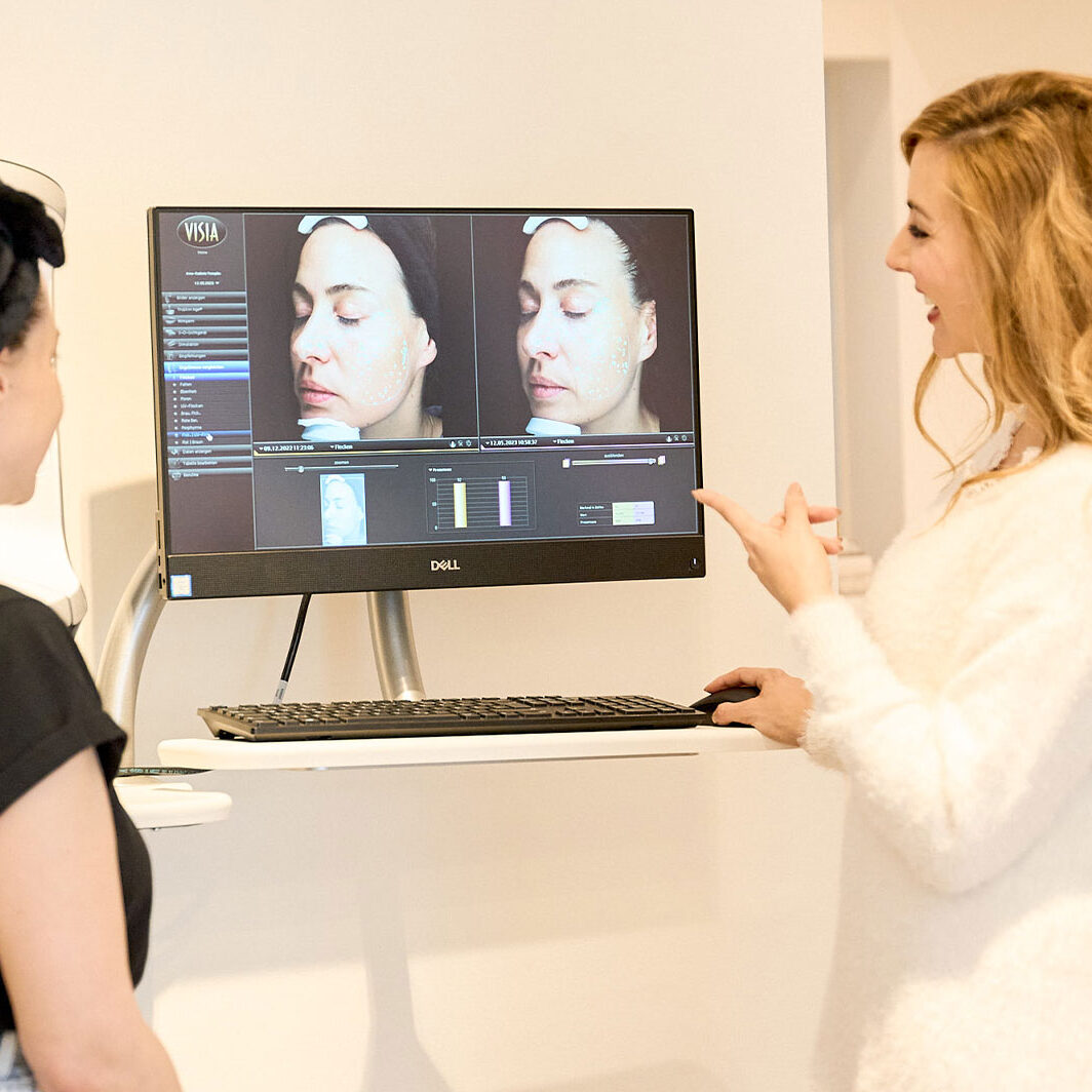 Freundliche Besprechung einer 3D Hautanalyse