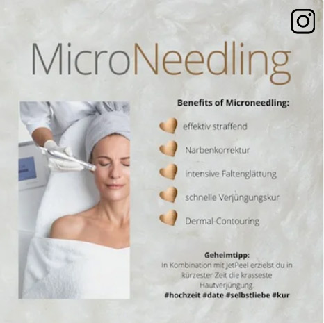 Bild mit Vorteilen von Microneedling
